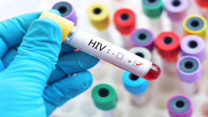 HIV-1280x720-1